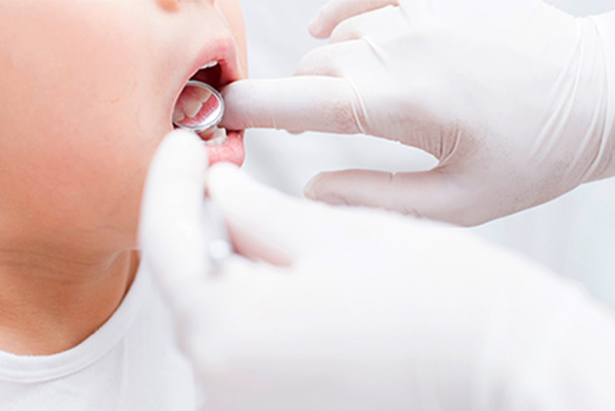 お口の発育に注目！保険診療でできる「口腔機能発達不全症」の検査・治療